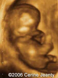 9w5d.1