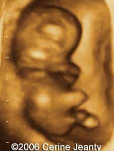 9w5d.2