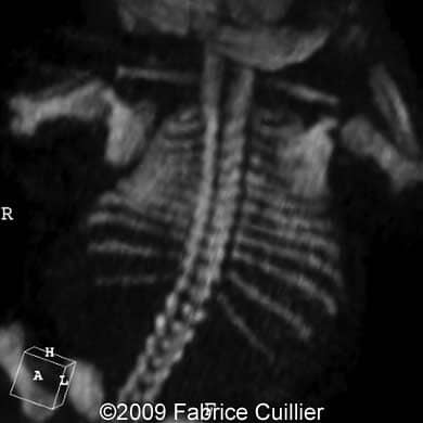 a - 4B