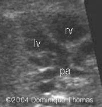 A PULM1(3)