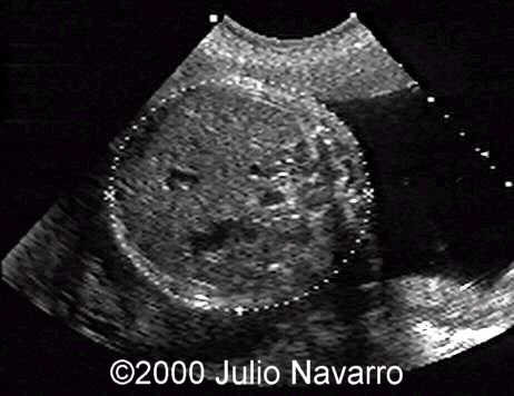 abdomen
