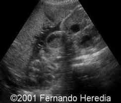 abdomen1