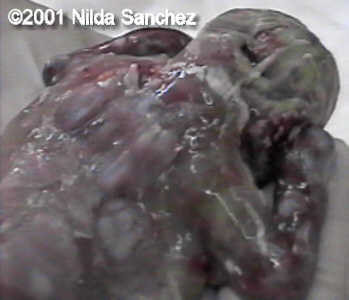 acardio7