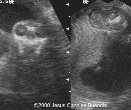 acrania2