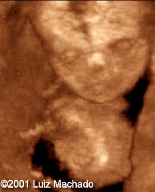 amelia nv3