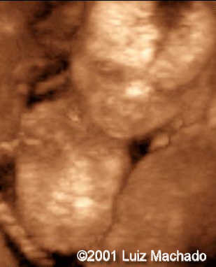 amelia nv4