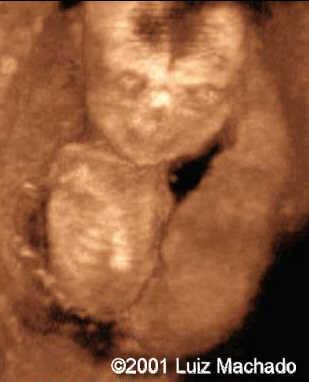 amelia nv5