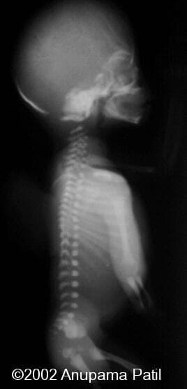 aruna ntd xray