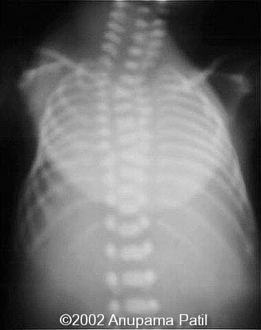 aruna ntd xray2