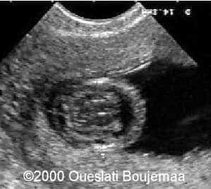 bip_11sa5j