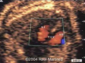 C011721