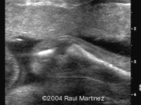 C011723