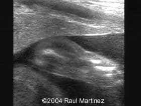 C011724