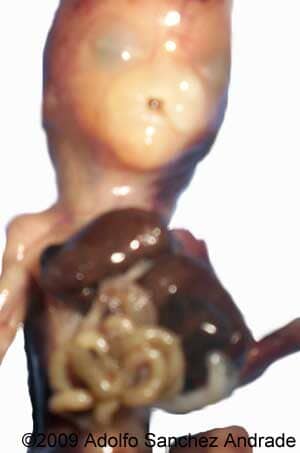 Cantrell_fetus_1