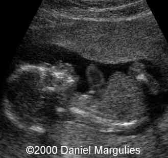 cantrell4