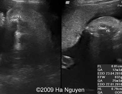 Case_257_10