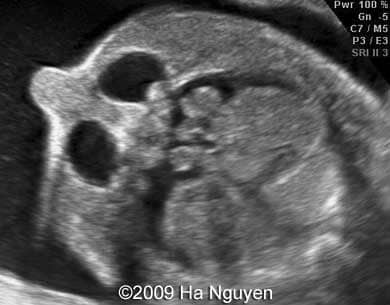 Case_257_12