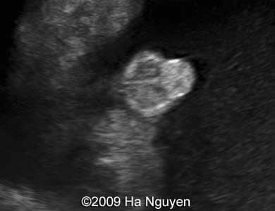 Case_257_13
