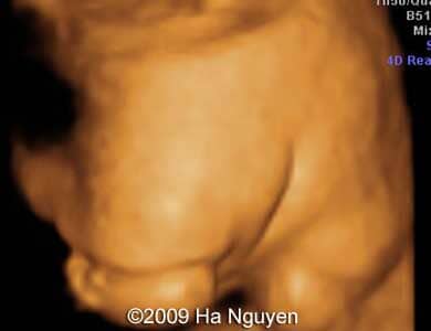 Case_257_14