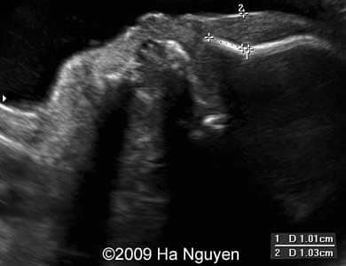 Case_257_2