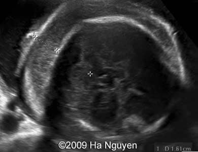 Case_257_3