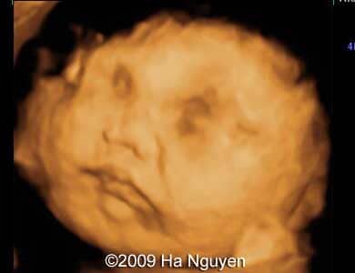 Case_257_4