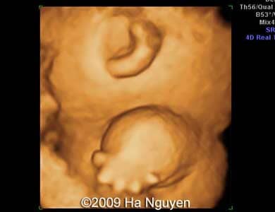 Case_257_6