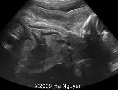 Case_257_7