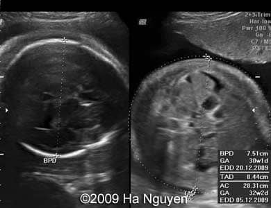 Case_257_8