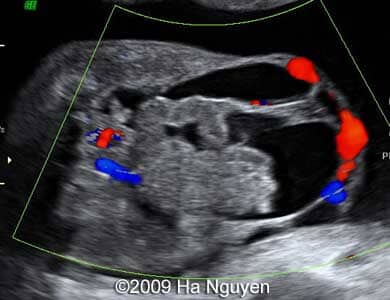 Case_257_9