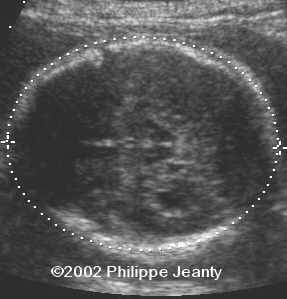 case 76-16