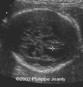 case 76-20