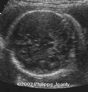 case 76-21