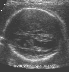 case 76-22