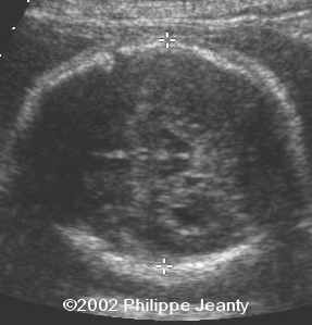 case 76-23