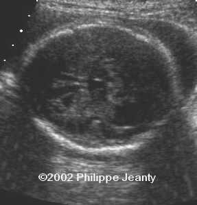case 76-25