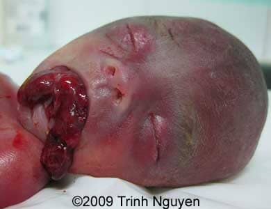 Case_Nguyen_5