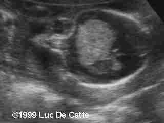 case0007-1