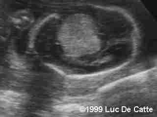 case0007-2
