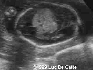 case0007-3