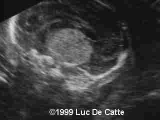 case0007-4