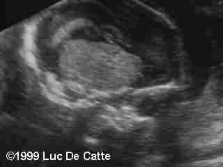 case0007-5