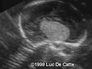 case0007-6