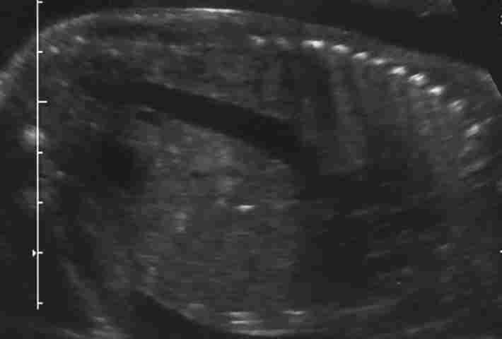 case0010-1
