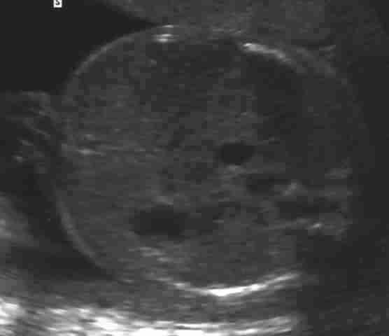 case0010-2