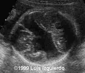 case0011-1