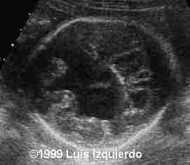 case0011-2