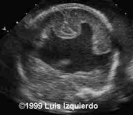 case0011-4
