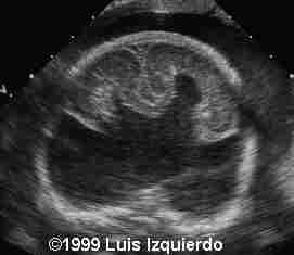 case0011-5