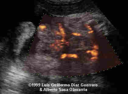 case0012-1